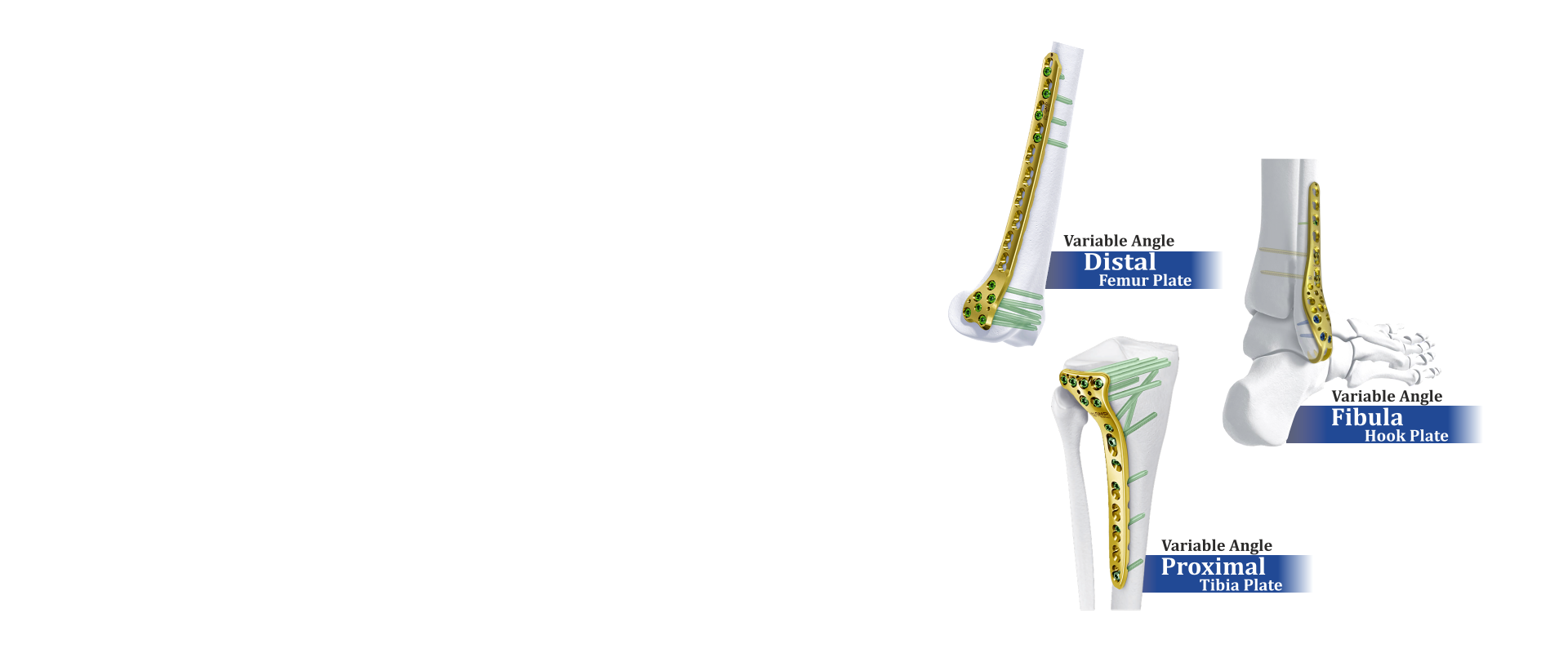 Variable Angle Plates