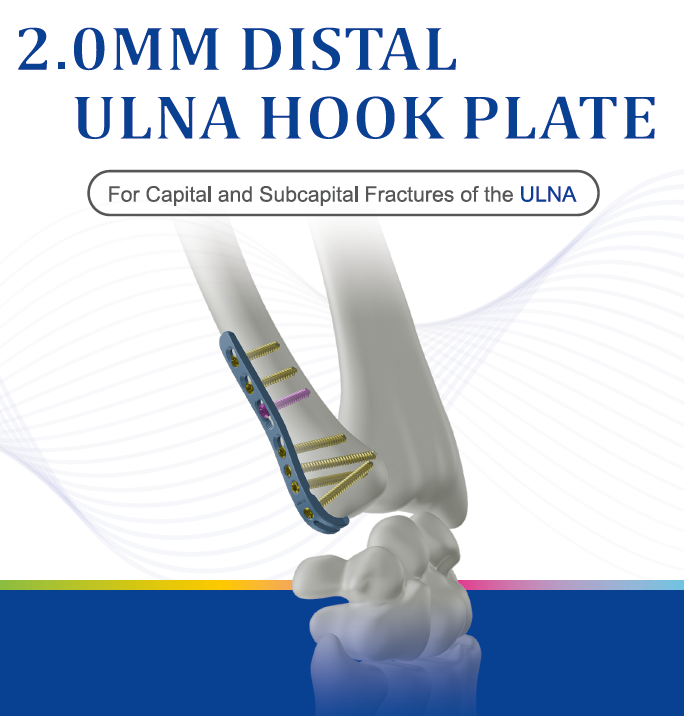 2.0mm Distal Ulna Plate-Brochure 2025-12-01_R2