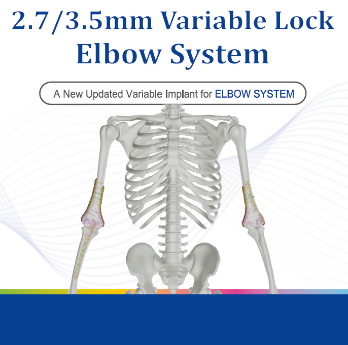 2.7 3.5mm Variable Lock Elbow System-2026-01-16_R1
