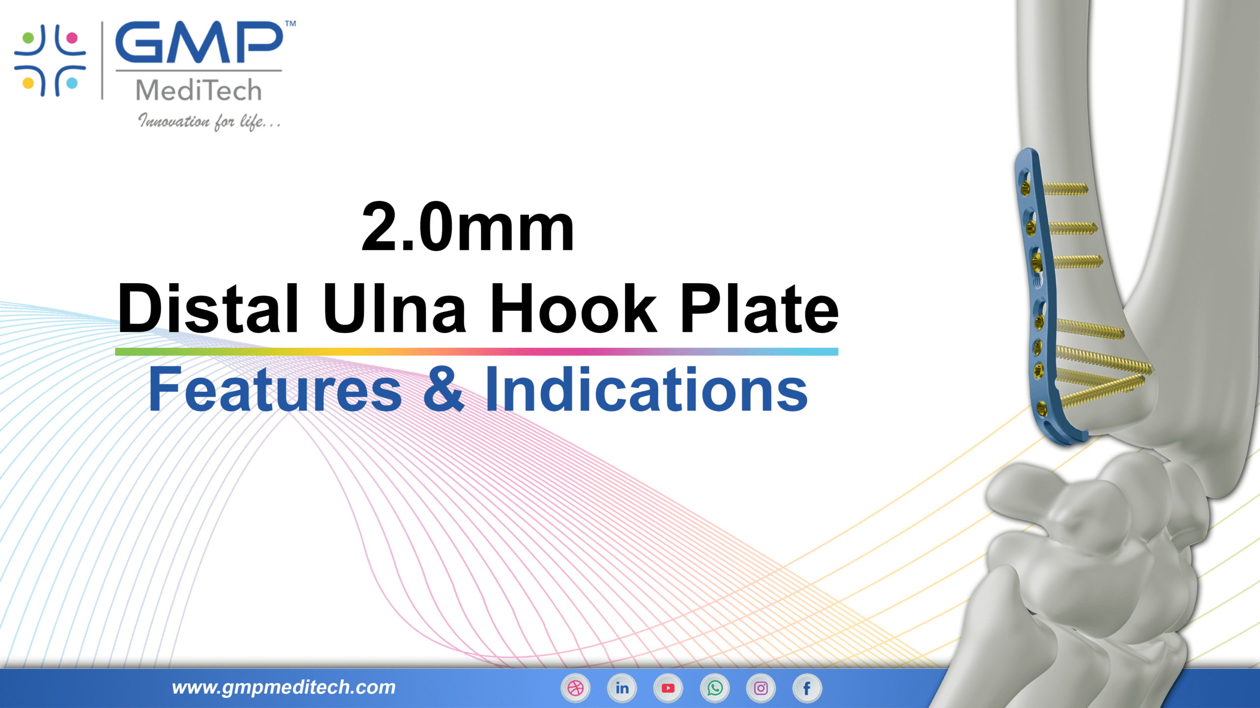 GMP MediTech – 2 0 mm Ulna Hook Plate Features & Indications