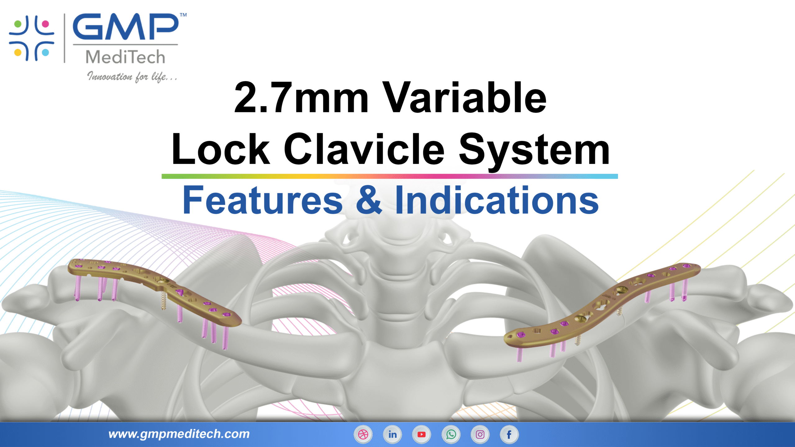 Variable Angle Clavicle Locking System | Advanced Fixation for Clavicle Fractures