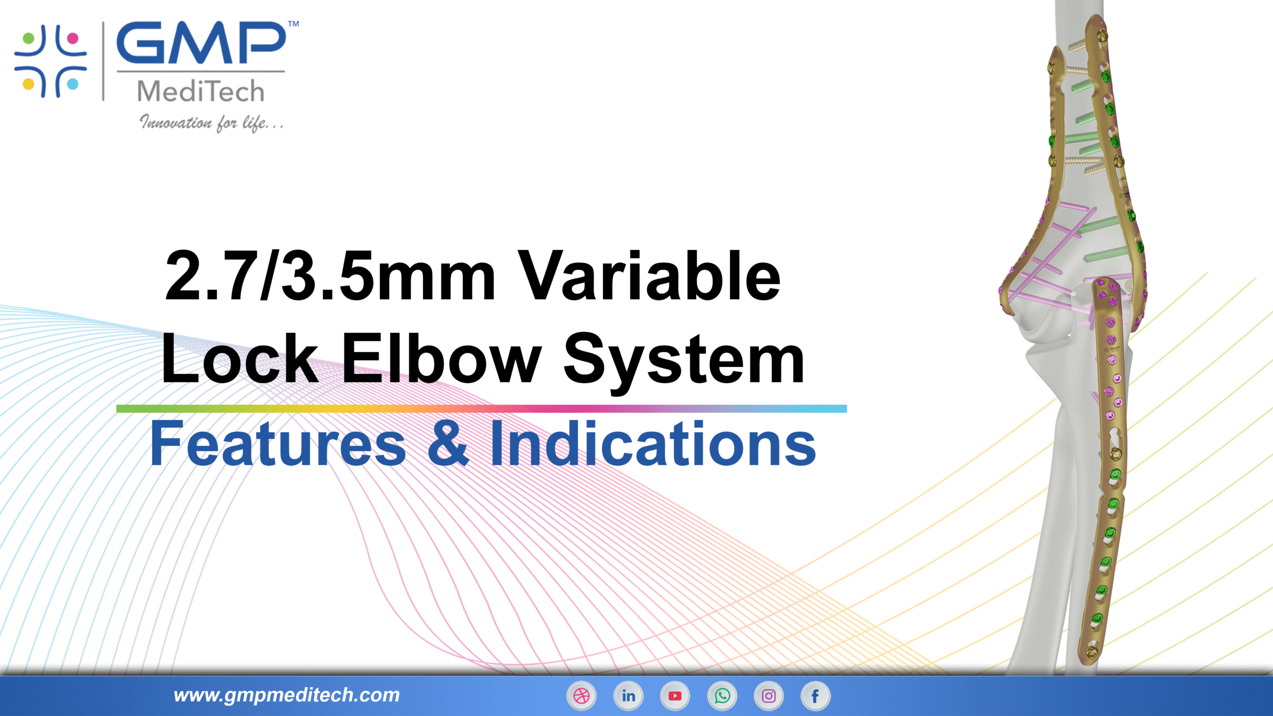 Complete Elbow Fixation Solutions – Variable System 2.7 / 3.5 mm