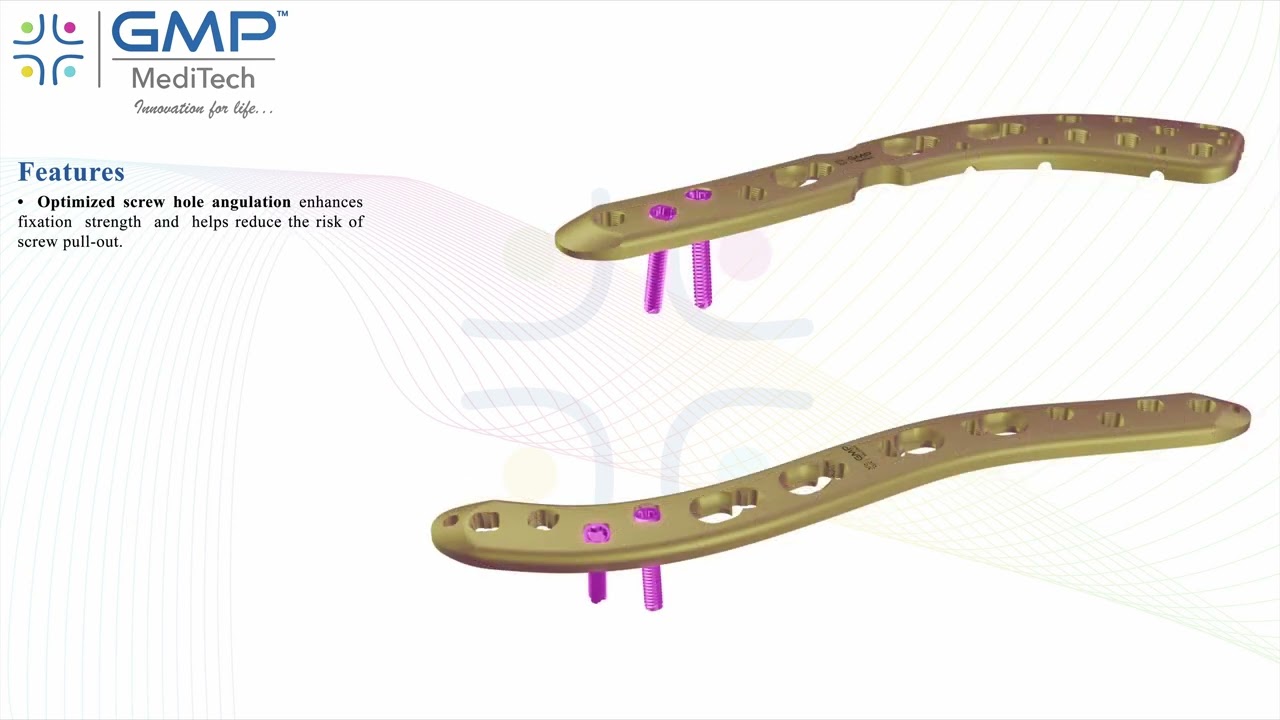 Variable Angle Clavicle Locking System | Advanced Fixation for Clavicle Fractures