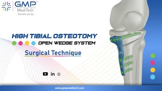 High tibial Osteotomy Open Wedge System – Surgical Technique