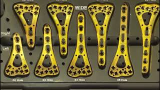 2.4/2.7mm Distal Radius Variable Angle System