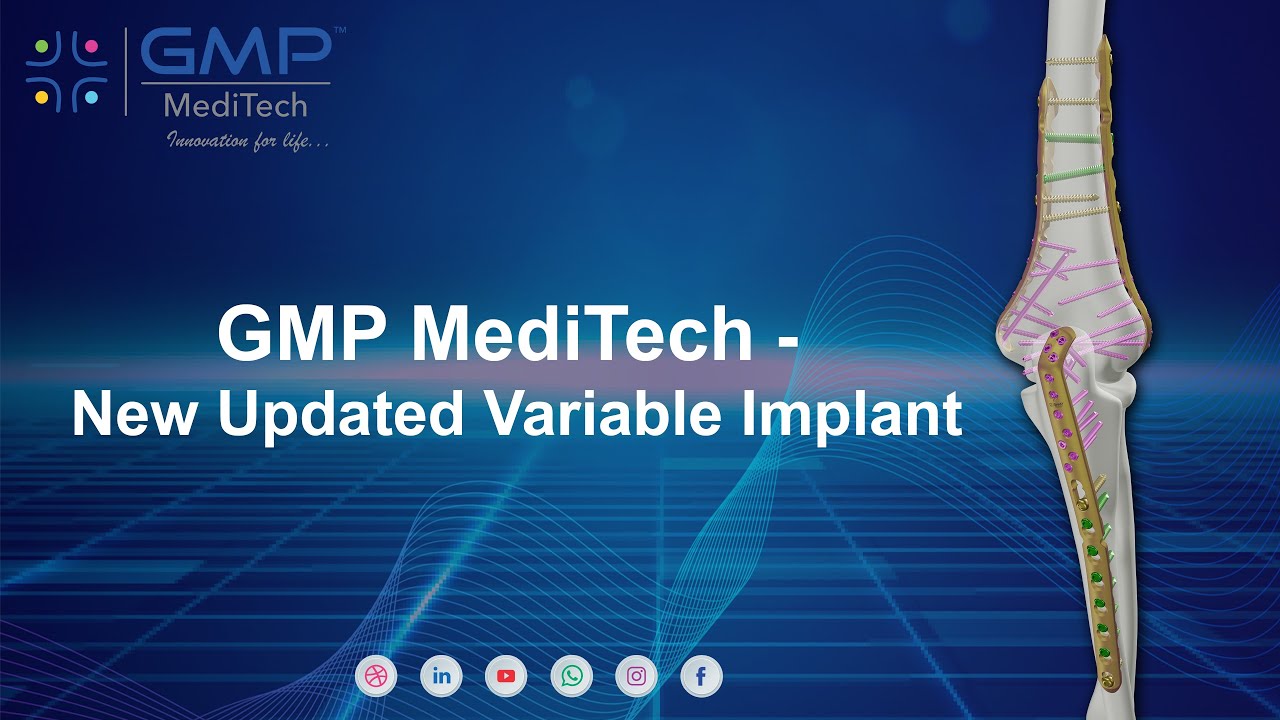 GMP MediTech- Updated Trauma variable Lock System