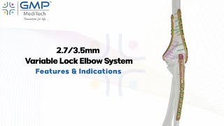 Complete Elbow Fixation Solutions – Variable System 2.7 / 3.5 mm