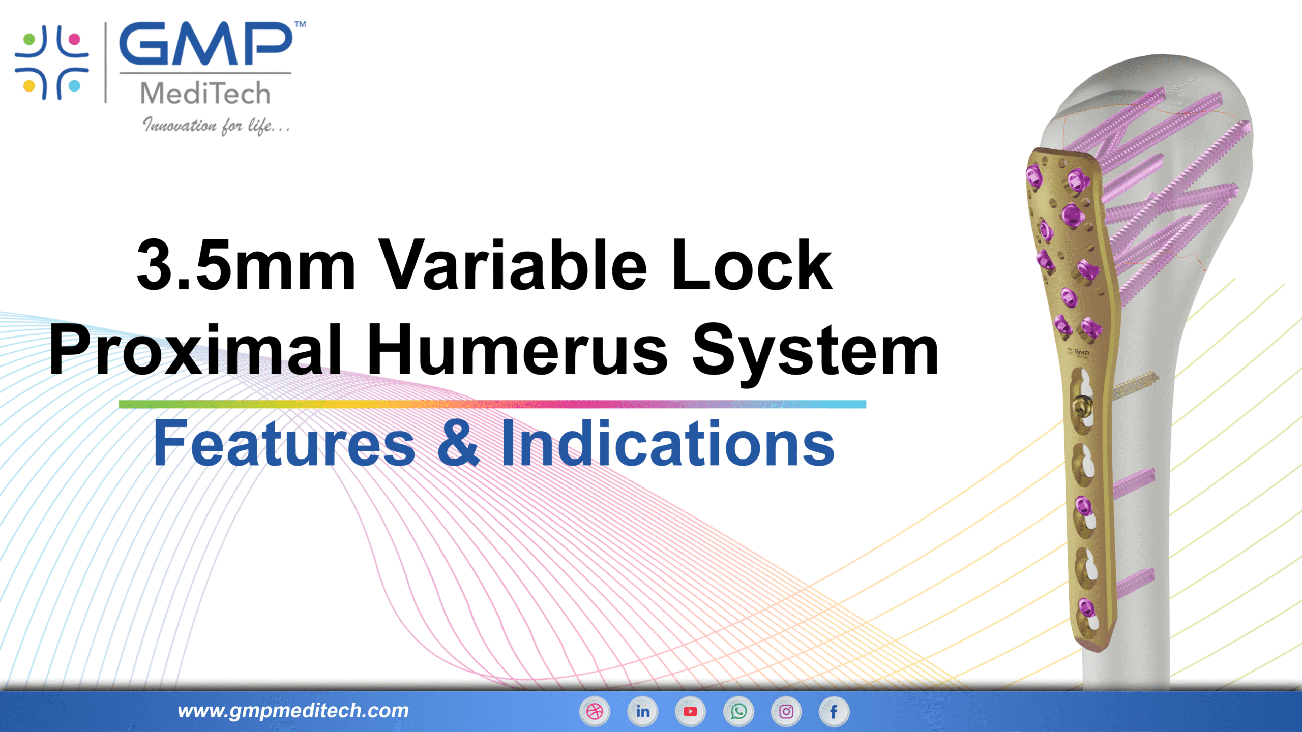 3.5mm Variable Angle Philos System