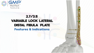 2.7/3.5mm Variable Angle Fibula Platting System (With or Without Hook)