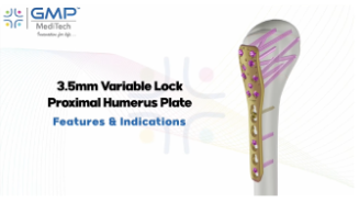 3.5mm Variable Angle Philos System