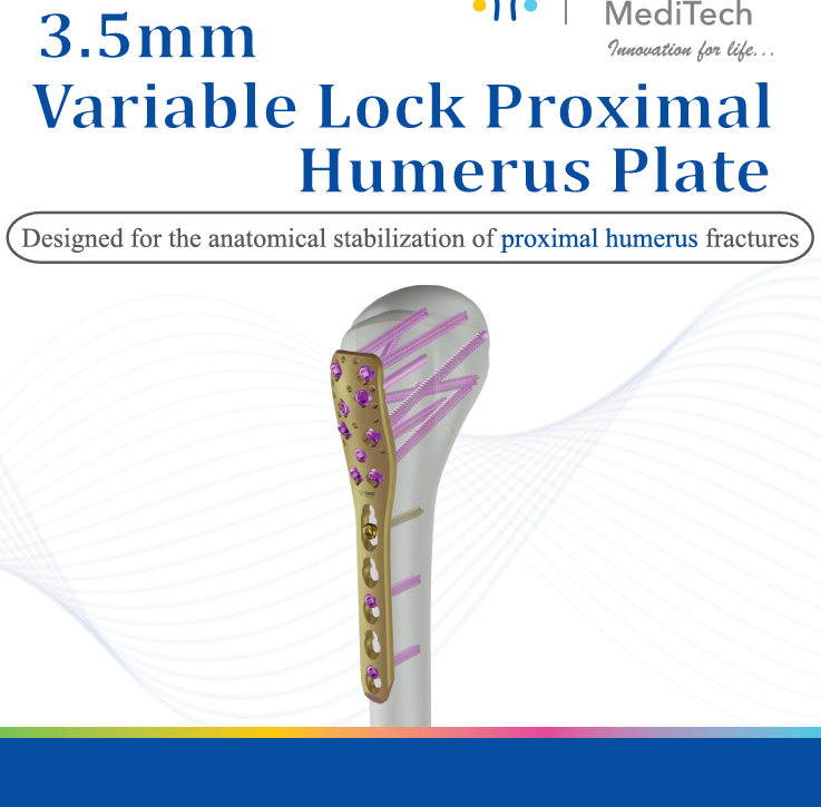 3.5mm Variable Lock Proximal Humerus System