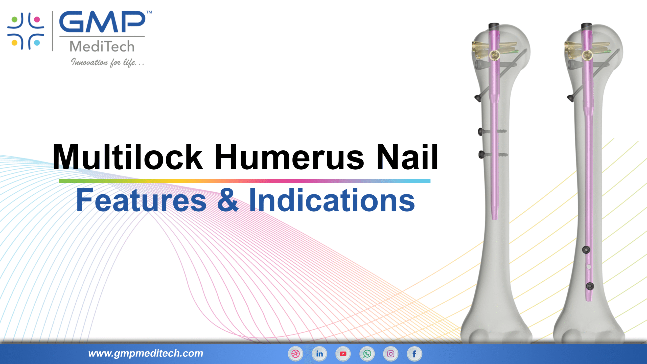 Multi Lock Humerus Nailing System