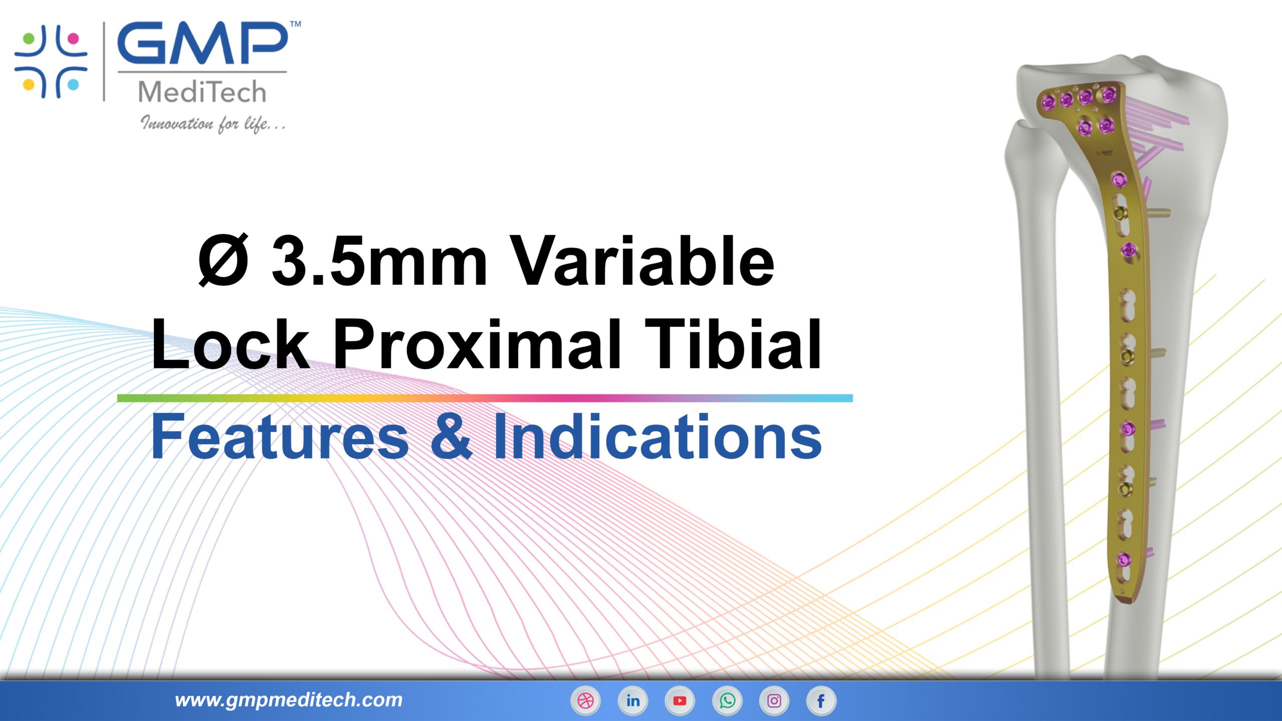 3.5mm Variable Lock Proximal Tibial Features & Indications Video