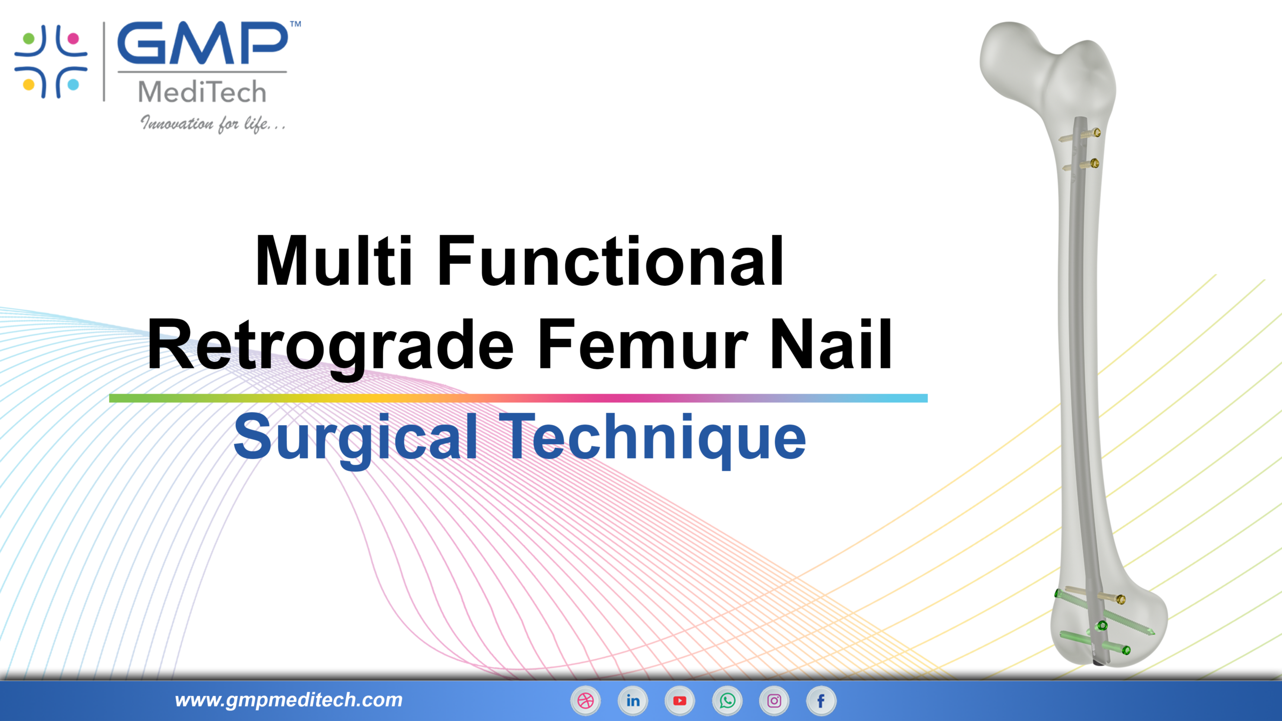 Multi Functional Retrograde Femur Nail | Distal Femur Nail Surgical Technique