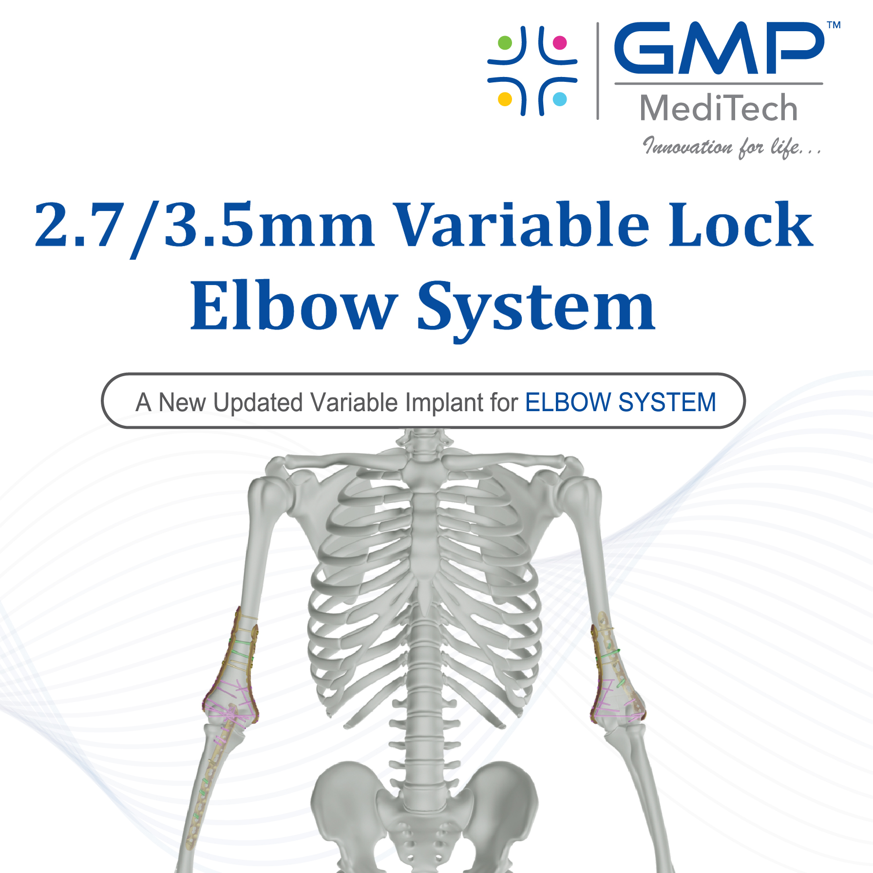 2.7 3.5mm Variable Lock Elbow System